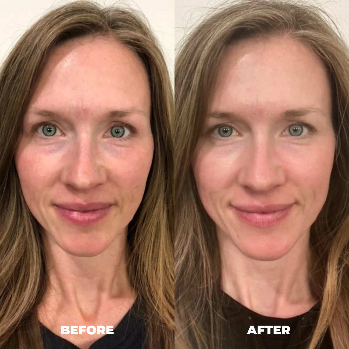 Jessie L. — RoyalGLOW Mask before and after